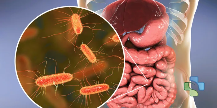 Film Array Gastrointestinal